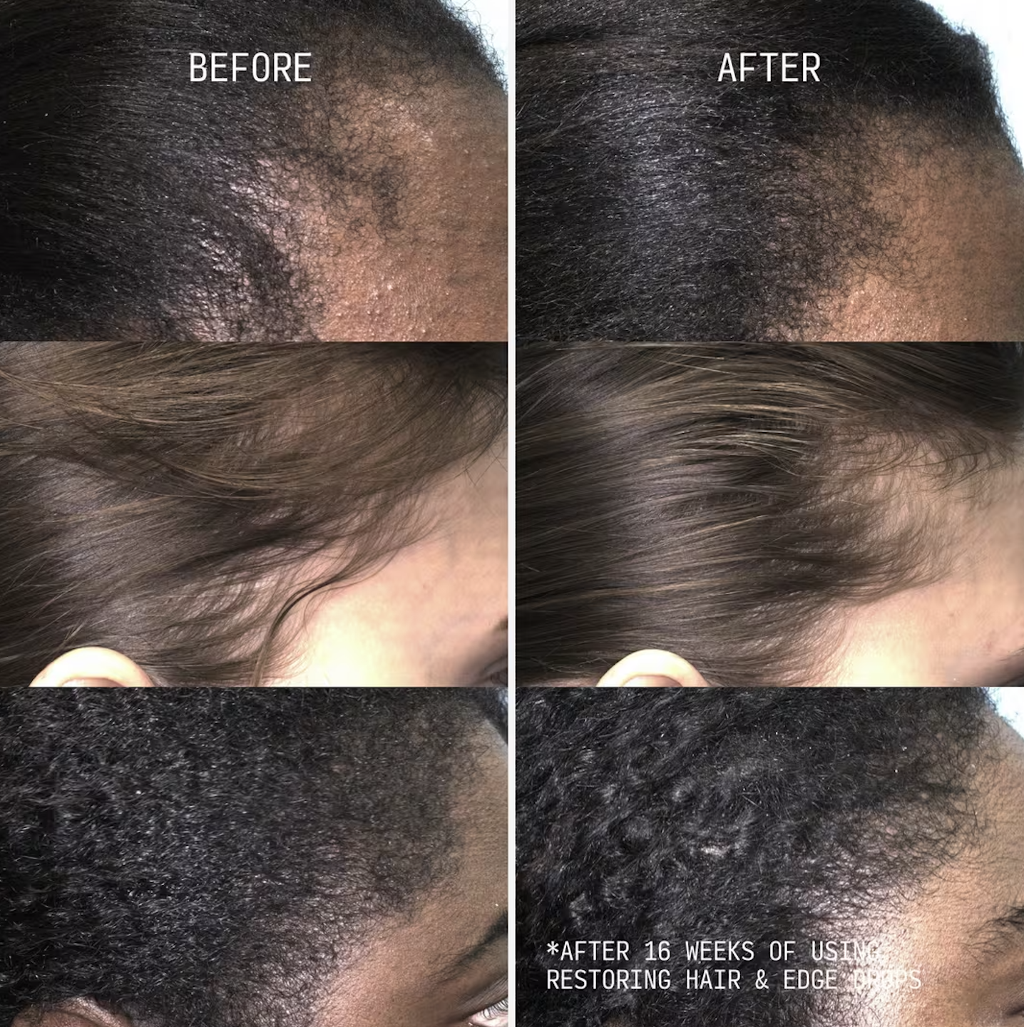 Is your hair thinning? Have you tried to regrow it and nothing has worked? You may be missing these key ingredients to grow your hair longer and stronger, without any drugs.